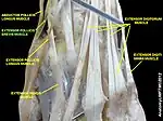 Extensor pollicis brevis muscle