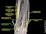 Extensor pollicis brevis muscle