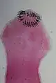 Taenia solium scolex (x400)