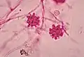 Macroconidia form of Histoplasma capsulatum