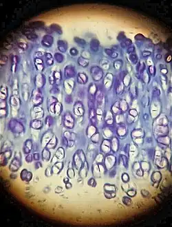 Hyaline cartilage coloured with the toluidine blue, in which you can observe a strong metachromasia of the ground substance. View through optical microscope, 40x magnification.