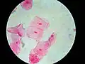 Human cheek cells (nonkeratinized stratified squamous epithelium) 500×