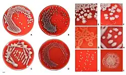 E.coli colonies on agar.