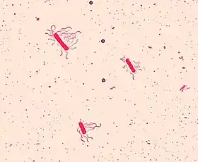 Bacillus cereus (Firmicutes)