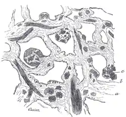 Corpul cavernos (microscopic)