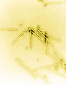 Electron micrograph of rod shaped TMV particles.
