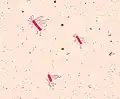 Bacillus cereus (Firmicutes)