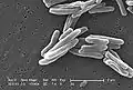 Mycobacterium tuberculosis (Actinobacteria)