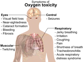 A diagraph showing a man torso and listing symptoms of oxygen toxicity: Eyes&nbsp;– visual field loss, near)sightedness, cataract formation, bleeding, fibrosis; Head&nbsp;– seizures; Muscles&nbsp;– twitching; Respiratory system&nbsp;– jerky breathing, irritation, coughing, pain, shortness of breath, tracheobronchitis, acute respiratory distress syndrome.