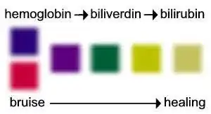 Hemoglobin / biliverdin / biulirubin colors