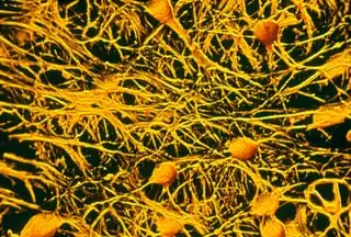 SEM human brain cells