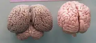 Dolphin brain (left) compared to human brain (right)