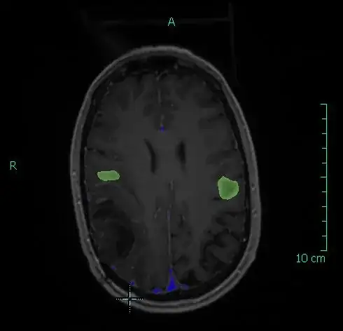 brain fmri