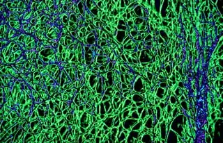 SEM mushroom mycelium